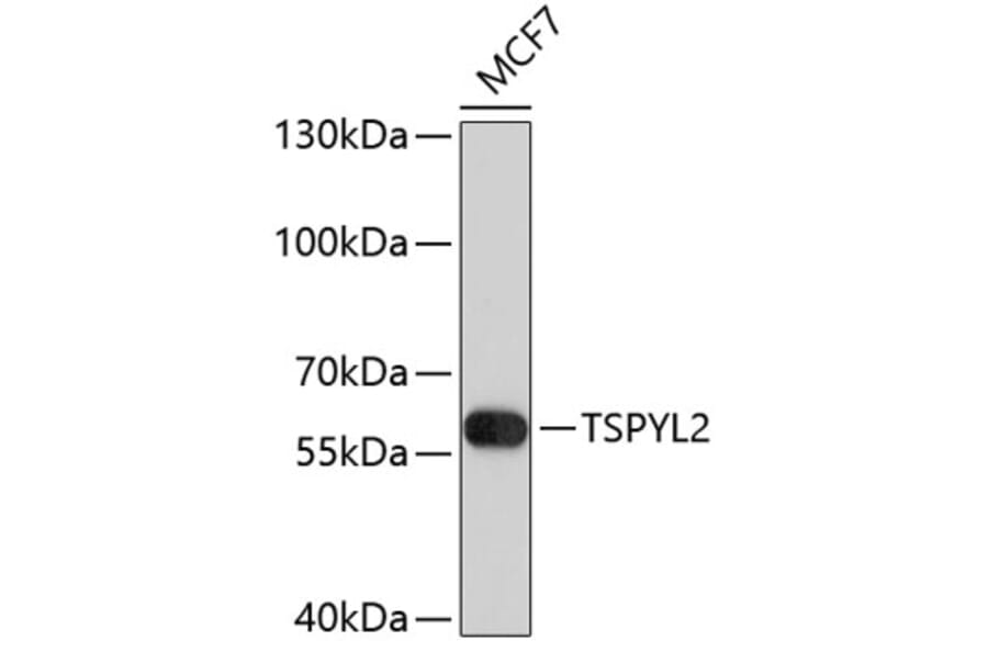 Western Blot - Anti-TSPYL2 Antibody (A8788) - Antibodies.com