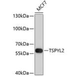 Western Blot - Anti-TSPYL2 Antibody (A8788) - Antibodies.com