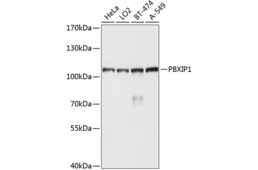Western Blot - Anti-PBXIP1/HPIP Antibody (A10515) - Antibodies.com