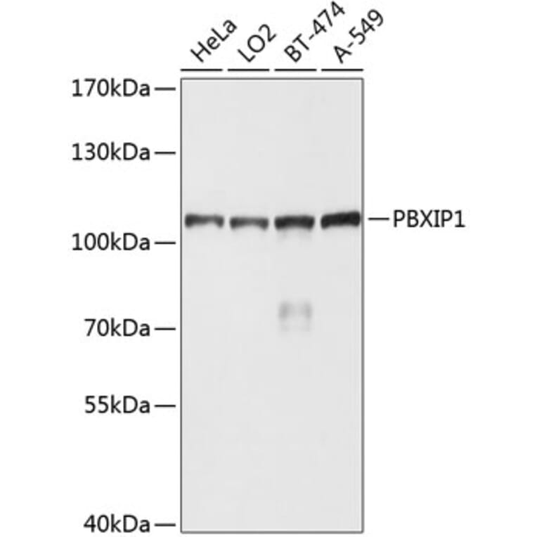 Western Blot - Anti-PBXIP1/HPIP Antibody (A10515) - Antibodies.com