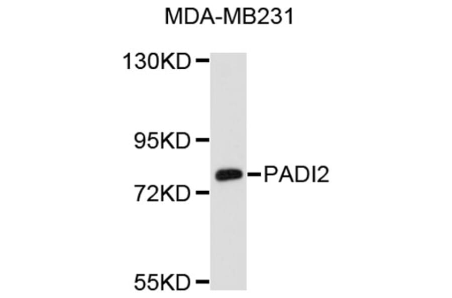 Western Blot - Anti-PADI2 Antibody (A8791) - Antibodies.com