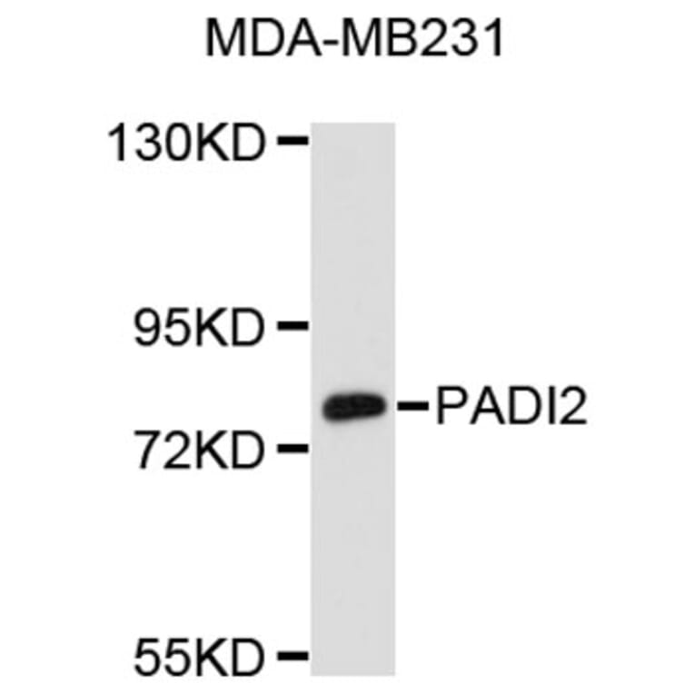 Western Blot - Anti-PADI2 Antibody (A8791) - Antibodies.com