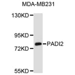 Western Blot - Anti-PADI2 Antibody (A8791) - Antibodies.com