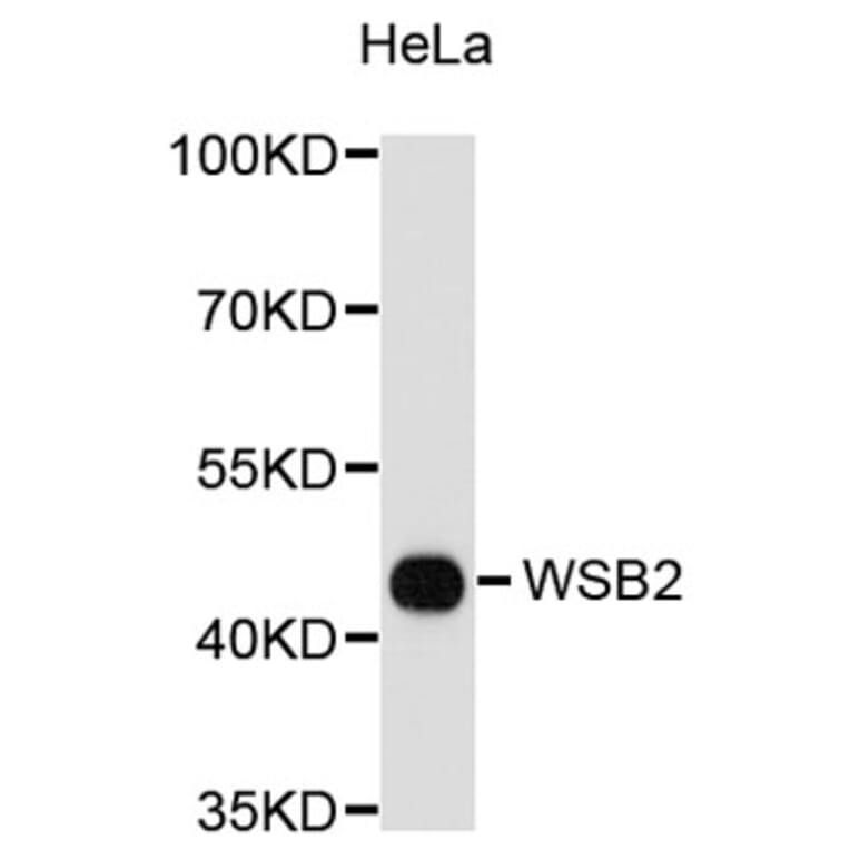 Western Blot - Anti-WSB2 Antibody (A8792) - Antibodies.com