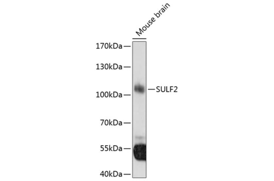 Western Blot - Anti-SULF2 Antibody (A8803) - Antibodies.com