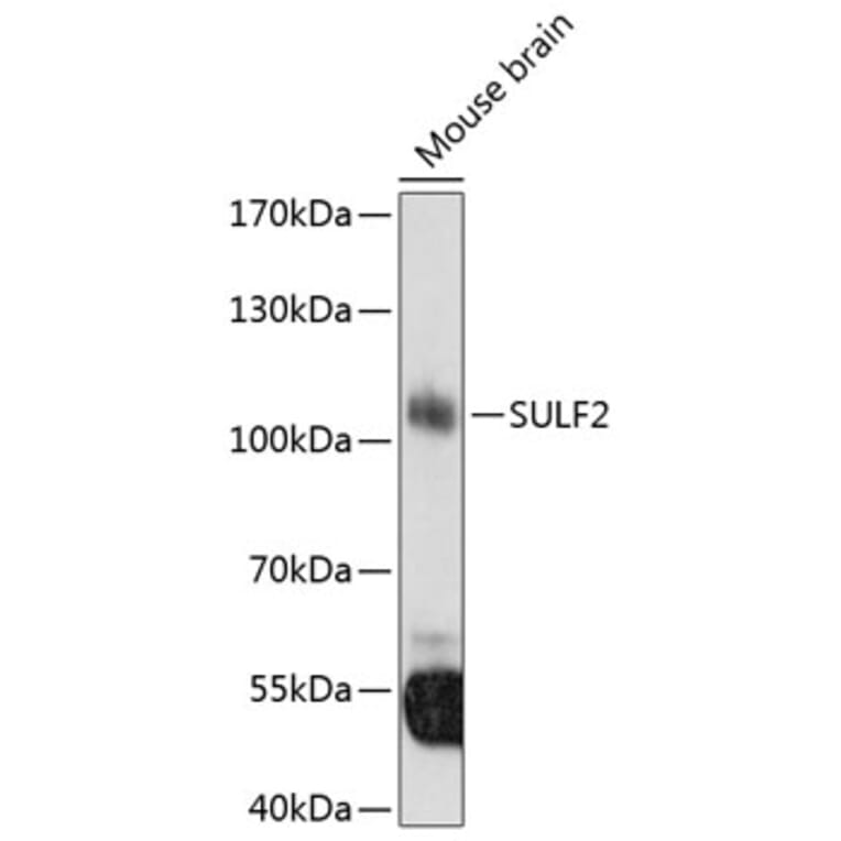 Western Blot - Anti-SULF2 Antibody (A8803) - Antibodies.com