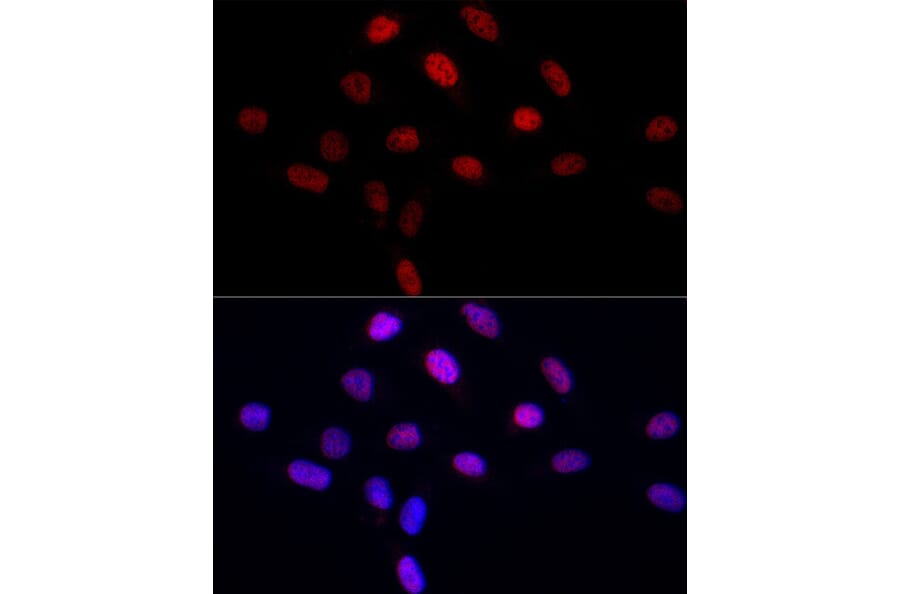Immunofluorescence - Anti-LEO1/RDL Antibody (A10520) - Antibodies.com