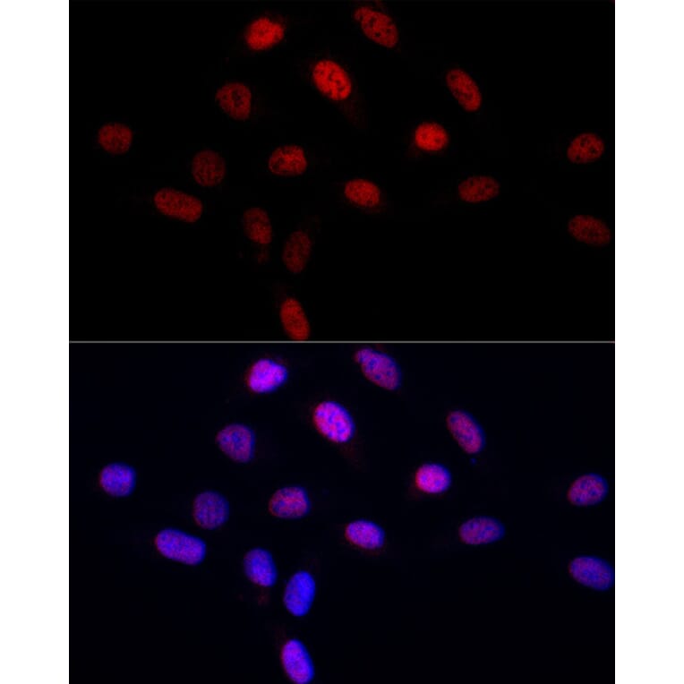 Immunofluorescence - Anti-LEO1/RDL Antibody (A10520) - Antibodies.com