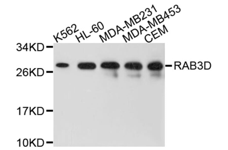 Western Blot - Anti-RAB3D Antibody (A8810) - Antibodies.com