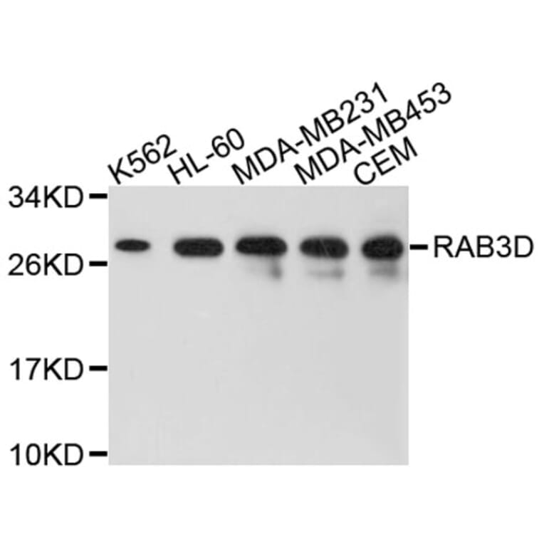 Western Blot - Anti-RAB3D Antibody (A8810) - Antibodies.com