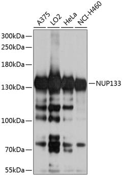 Western blot analysis of extracts of various cell lines, using Anti-NUP133 Antibody (A8818) at 1:1,000 dilution.
Secondary antibody: Goat Anti-Rabbit IgG (H+L) (HRP) (AS014) at 1:10,000 dilution.
Lysates / proteins: 25µg per lane.
Blocking buffer: 3% non-fat dry milk in TBST.
Detection: ECL Basic Kit (RM00020).
Exposure time: 5s.