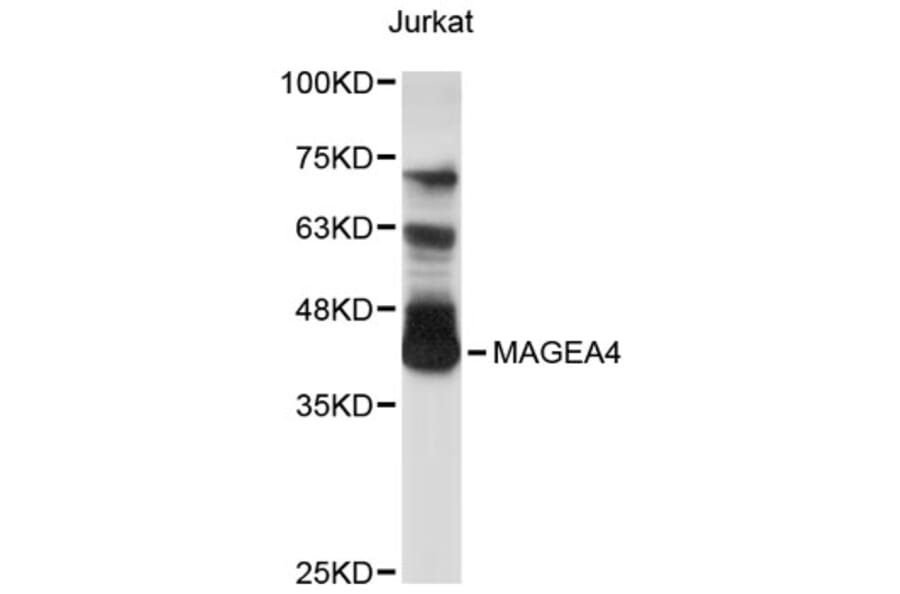 Western Blot - Anti-MAGEA4 Antibody (A8829) - Antibodies.com