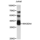Western Blot - Anti-MAGEA4 Antibody (A8829) - Antibodies.com