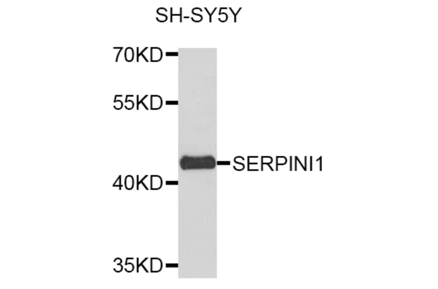 Western Blot - Anti-SERPINI1 Antibody (A8833) - Antibodies.com