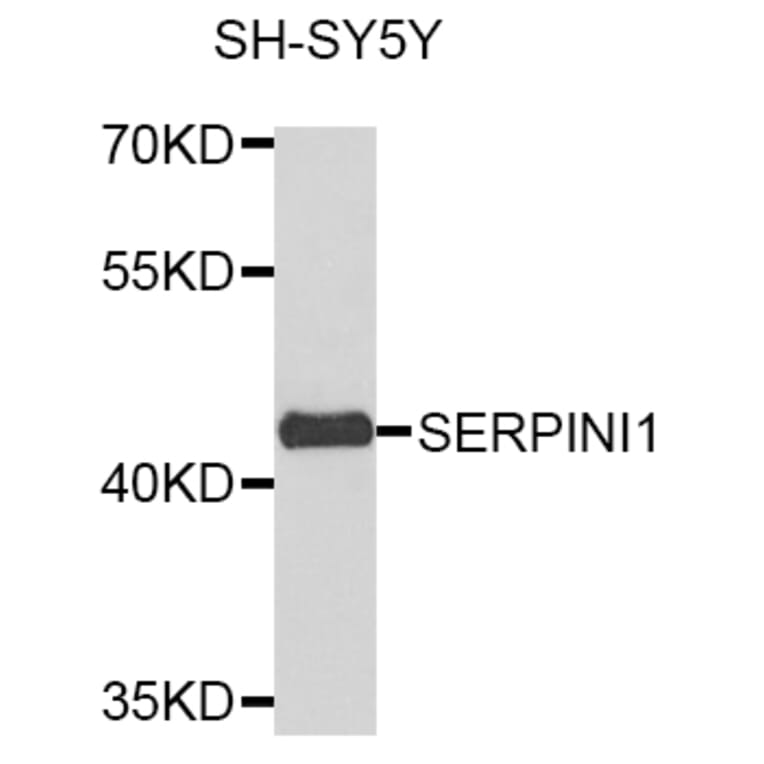 Western Blot - Anti-SERPINI1 Antibody (A8833) - Antibodies.com