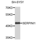 Western Blot - Anti-SERPINI1 Antibody (A8833) - Antibodies.com