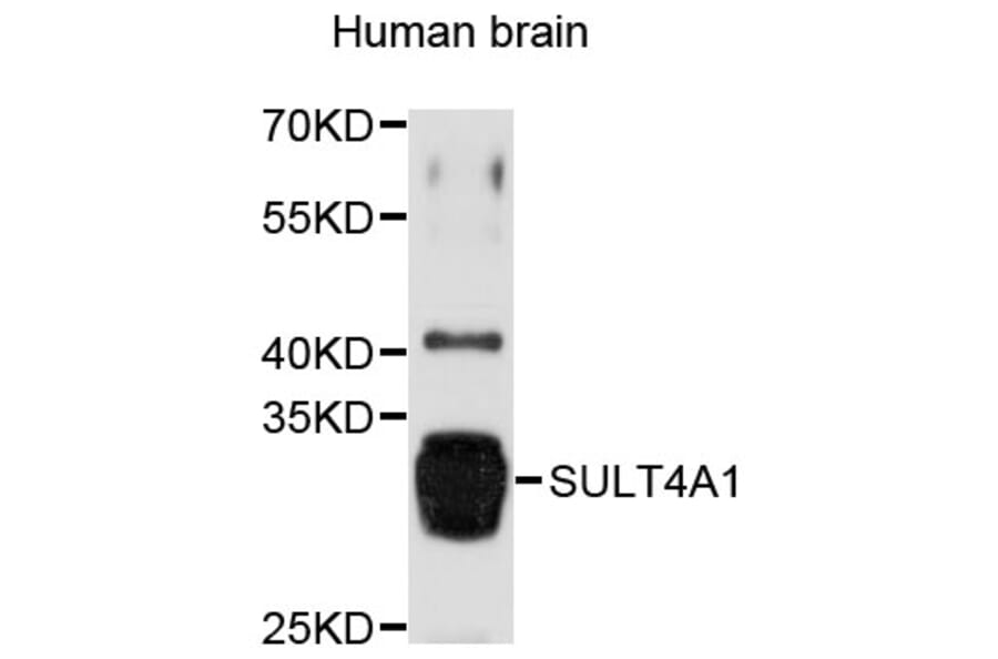 Western Blot - Anti-SULT4A1 Antibody (A8837) - Antibodies.com
