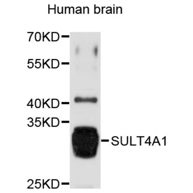 Western Blot - Anti-SULT4A1 Antibody (A8837) - Antibodies.com