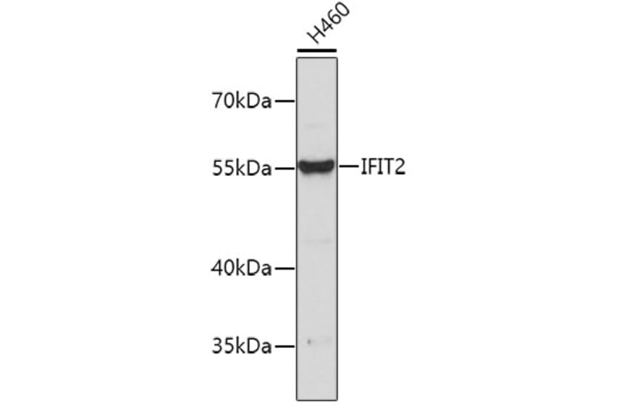 Western Blot - Anti-IFIT2 Antibody (A8841) - Antibodies.com