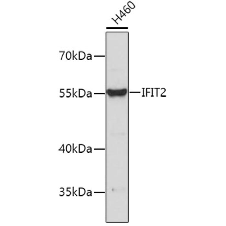 Western Blot - Anti-IFIT2 Antibody (A8841) - Antibodies.com