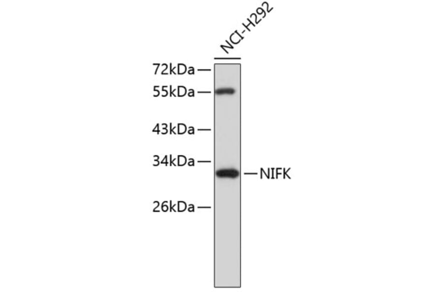 Western Blot - Anti-NIFK Antibody (A8843) - Antibodies.com
