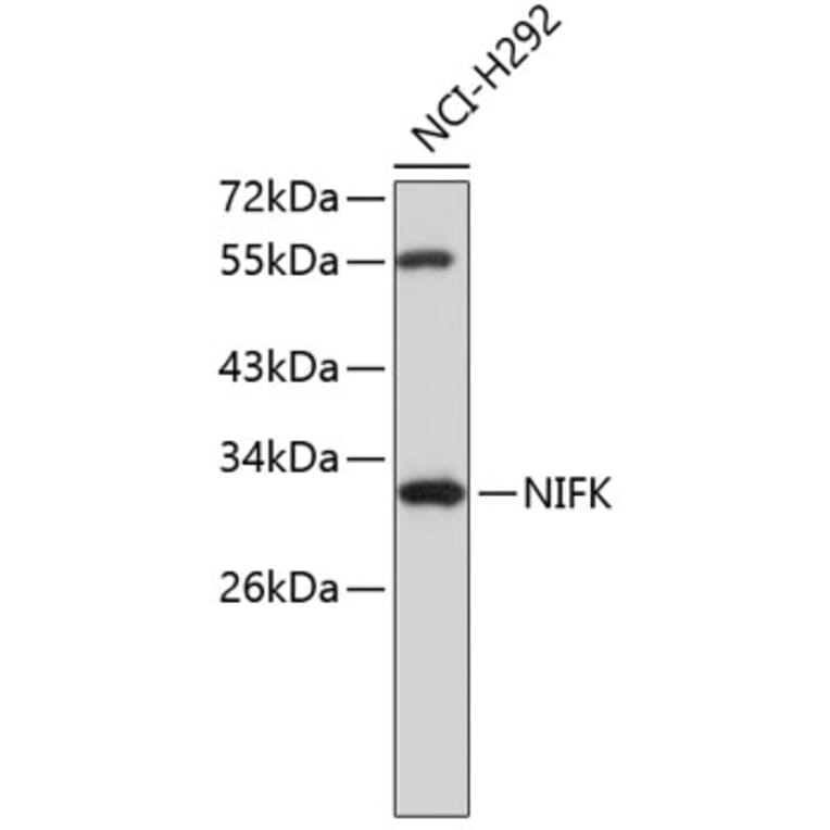 Western Blot - Anti-NIFK Antibody (A8843) - Antibodies.com