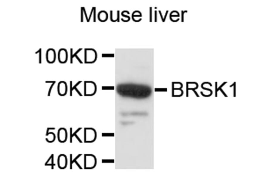 Western Blot - Anti-BRSK1 Antibody (A8848) - Antibodies.com