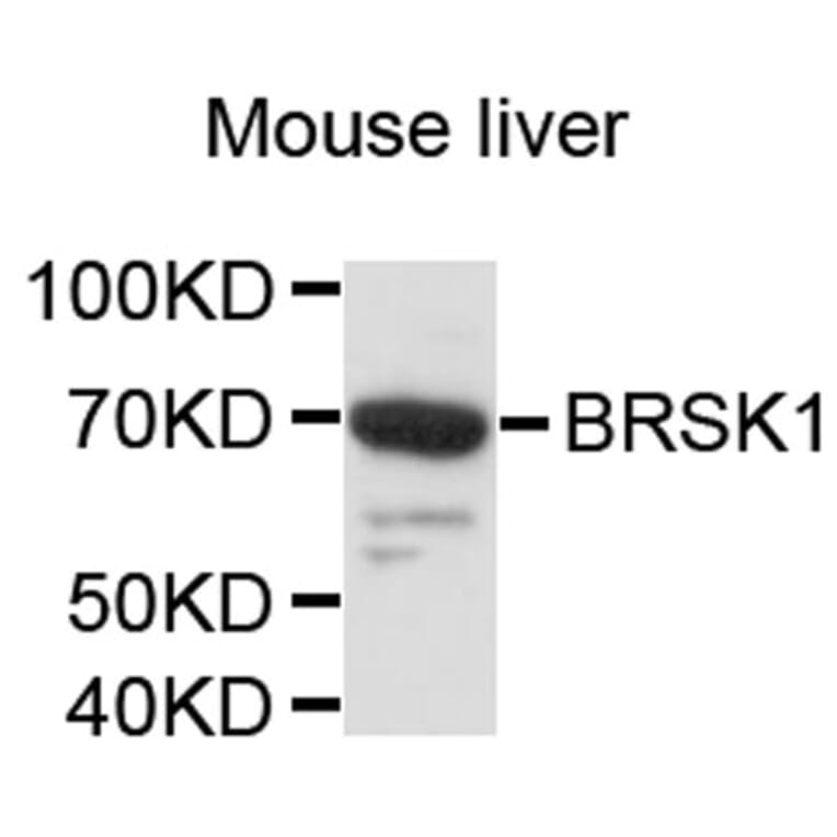 Western Blot - Anti-BRSK1 Antibody (A8848) - Antibodies.com