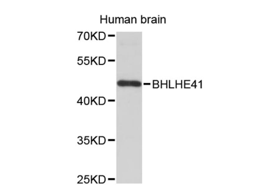 Western Blot - Anti-BHLHE41 Antibody (A8849) - Antibodies.com