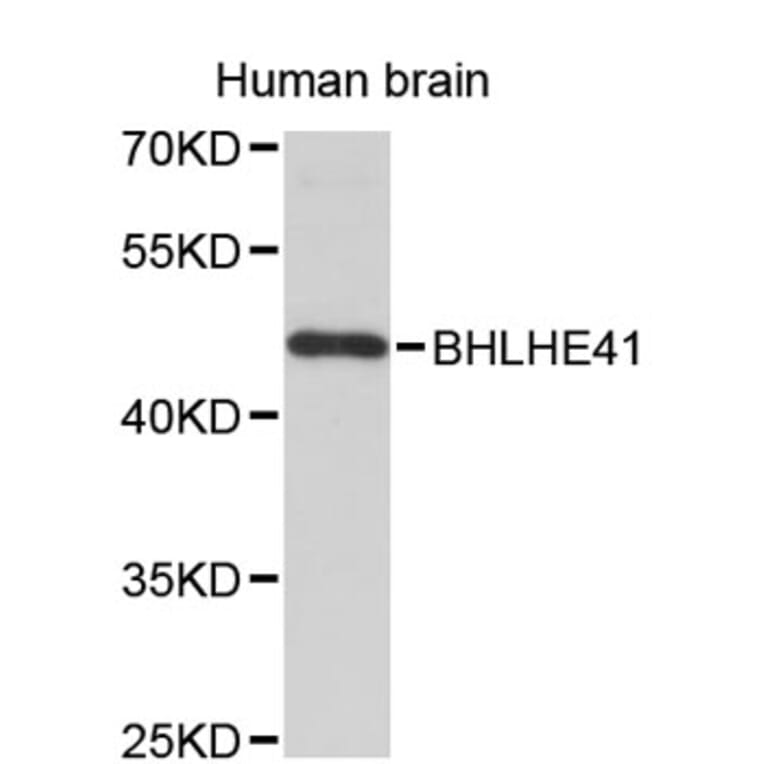 Western Blot - Anti-BHLHE41 Antibody (A8849) - Antibodies.com