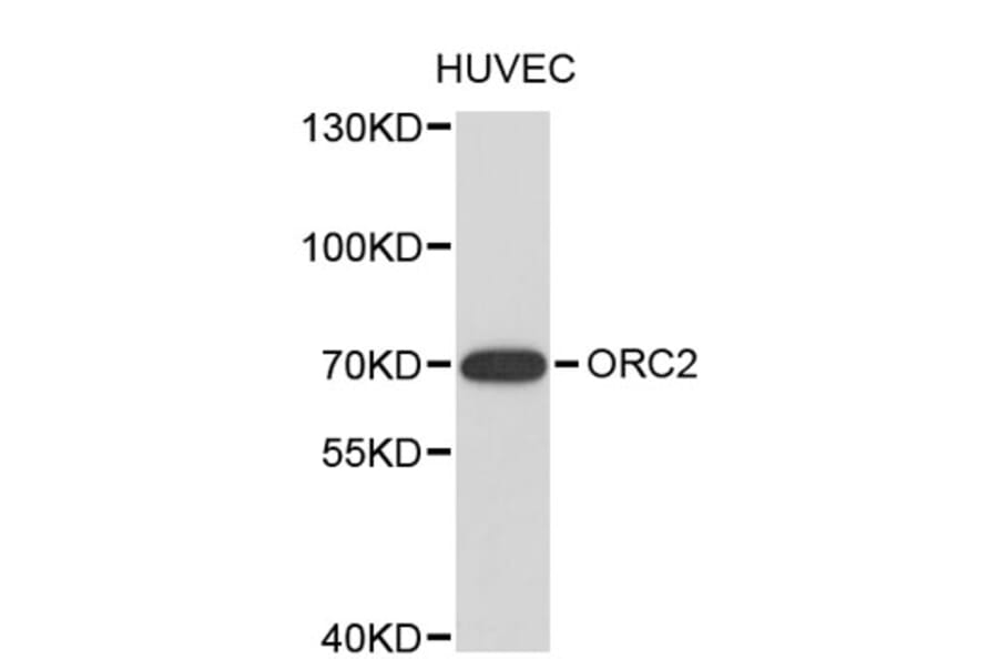 Western Blot - Anti-ORC2 Antibody (A8853) - Antibodies.com