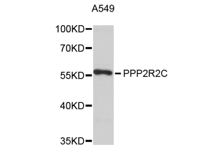Western Blot - Anti-PPP2R2C Antibody (A8854) - Antibodies.com