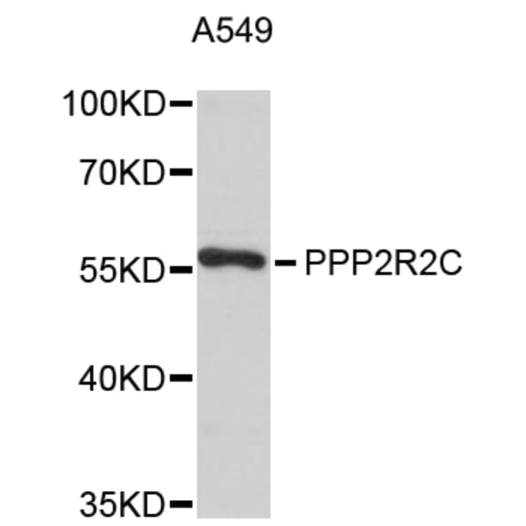 Western Blot - Anti-PPP2R2C Antibody (A8854) - Antibodies.com