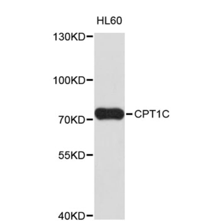 Western Blot - Anti-CPT1C Antibody (A8864) - Antibodies.com