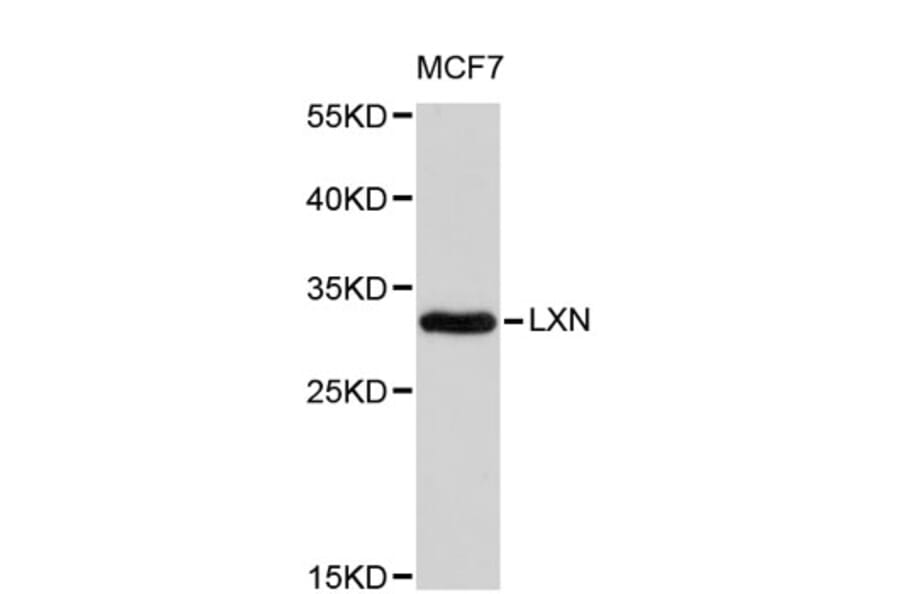 Western Blot - Anti-LXN Antibody (A8870) - Antibodies.com