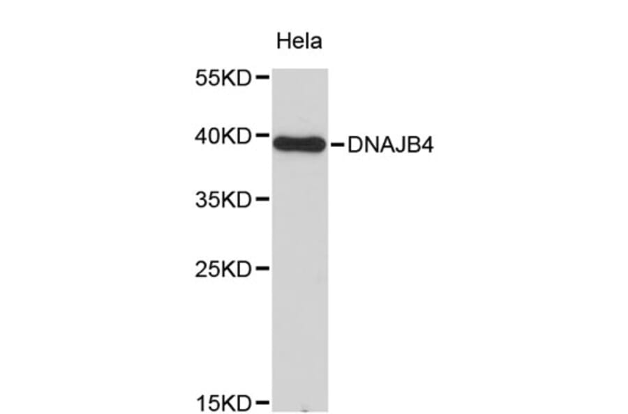 Western Blot - Anti-DNAJB4 Antibody (A8873) - Antibodies.com