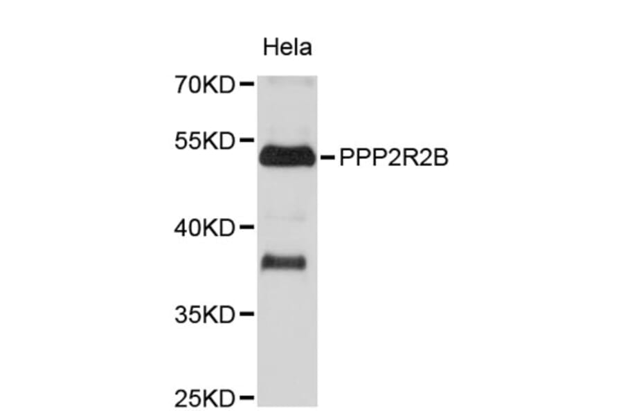 Western Blot - Anti-PPP2R2B Antibody (A8878) - Antibodies.com