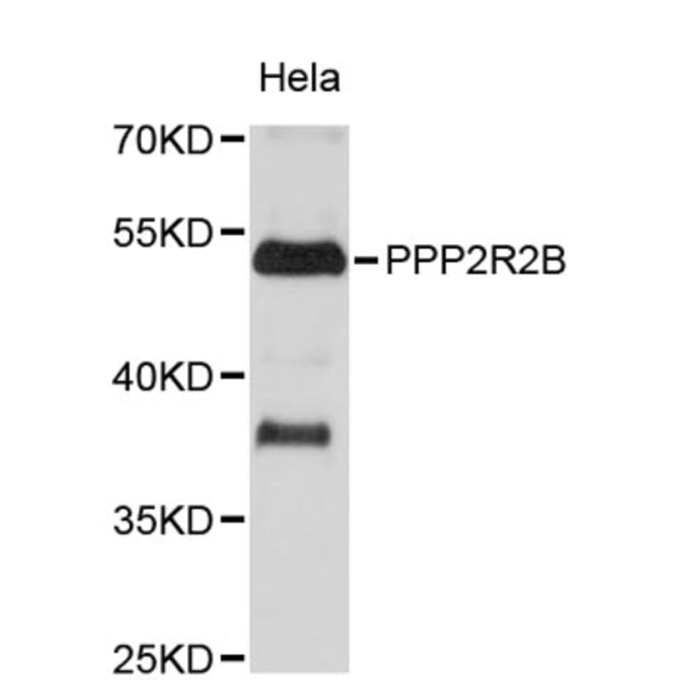 Western Blot - Anti-PPP2R2B Antibody (A8878) - Antibodies.com