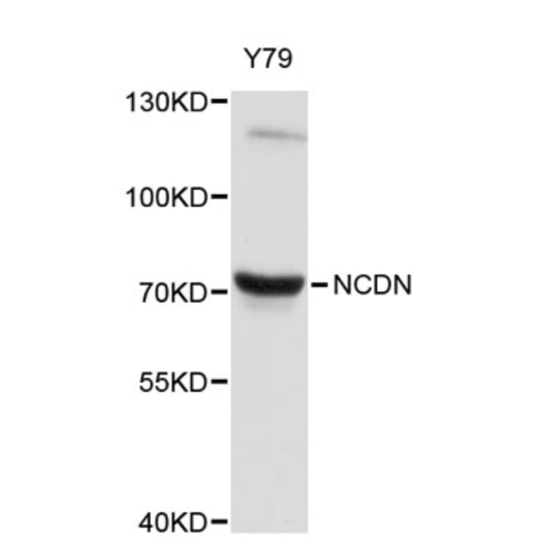 Western Blot - Anti-NCDN Antibody (A8882) - Antibodies.com