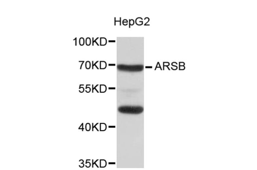 Western Blot - Anti-ARSB Antibody (A8886) - Antibodies.com