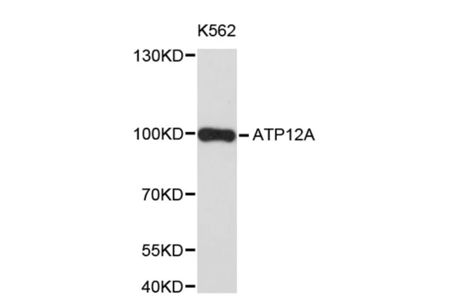 Western Blot - Anti-ATP12A Antibody (A8887) - Antibodies.com