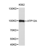 Western Blot - Anti-ATP12A Antibody (A8887) - Antibodies.com