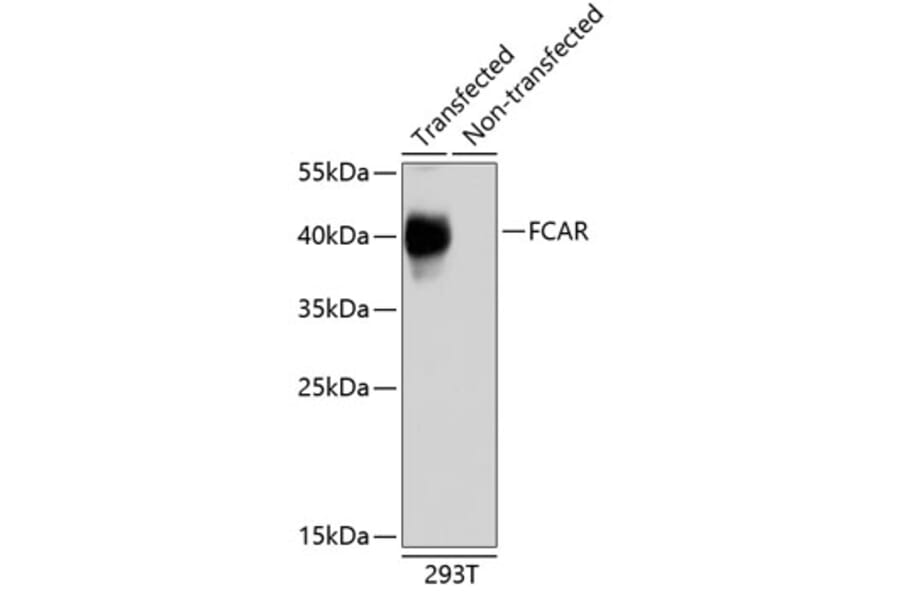 Western Blot - Anti-CD89 Antibody (A10545) - Antibodies.com