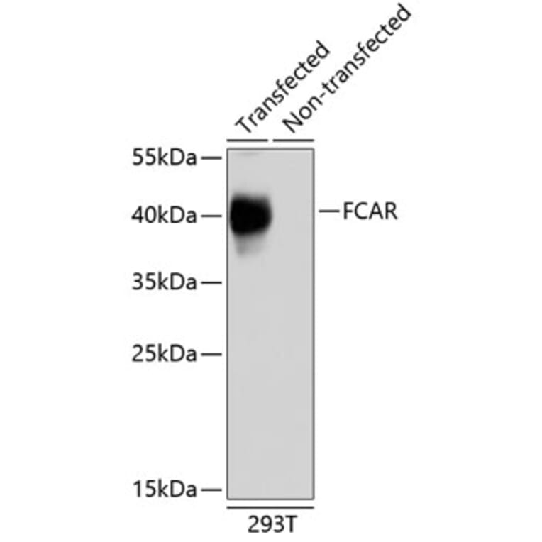 Western Blot - Anti-CD89 Antibody (A10545) - Antibodies.com