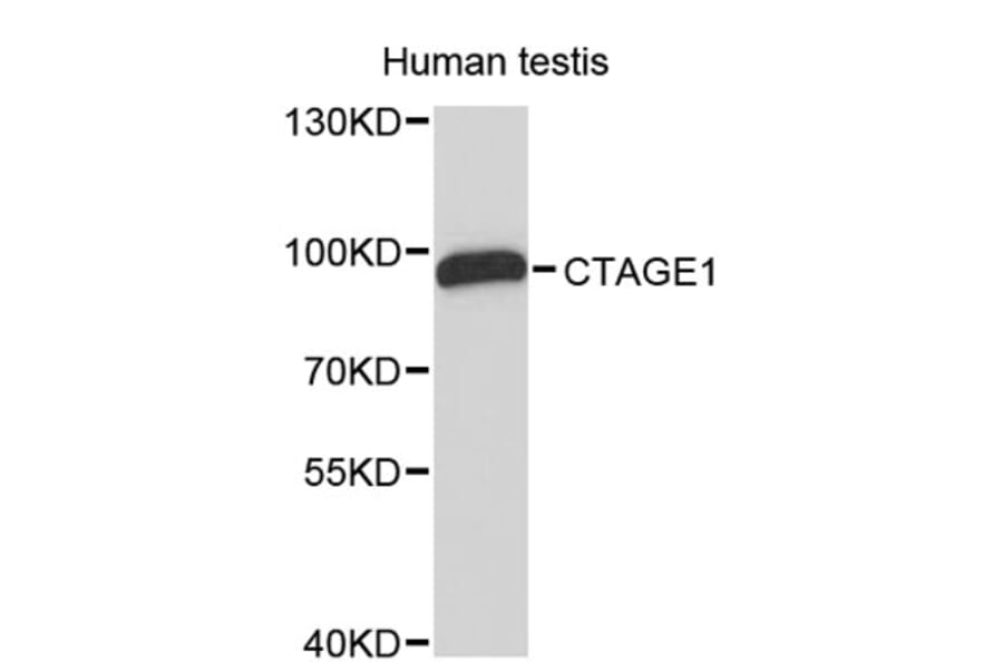 Western Blot - Anti-CTAGE1 Antibody (A8890) - Antibodies.com