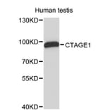 Western Blot - Anti-CTAGE1 Antibody (A8890) - Antibodies.com