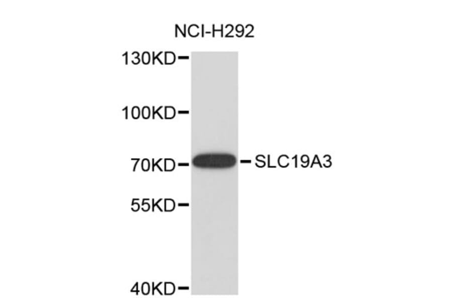 Western Blot - Anti-SLC19A3 Antibody (A8896) - Antibodies.com