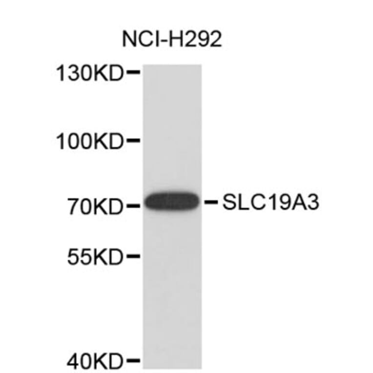 Western Blot - Anti-SLC19A3 Antibody (A8896) - Antibodies.com