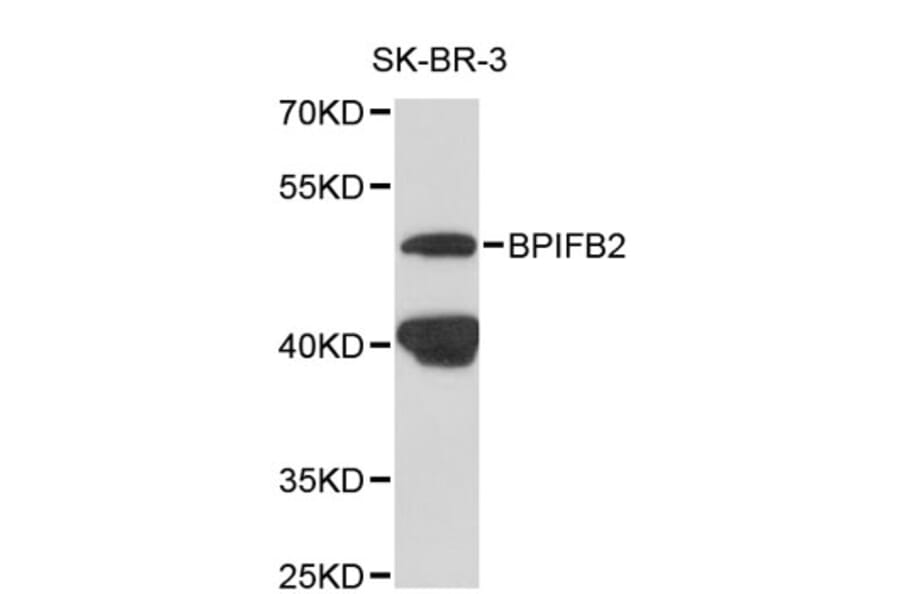 Western Blot - Anti-BPIFB2 Antibody (A8902) - Antibodies.com