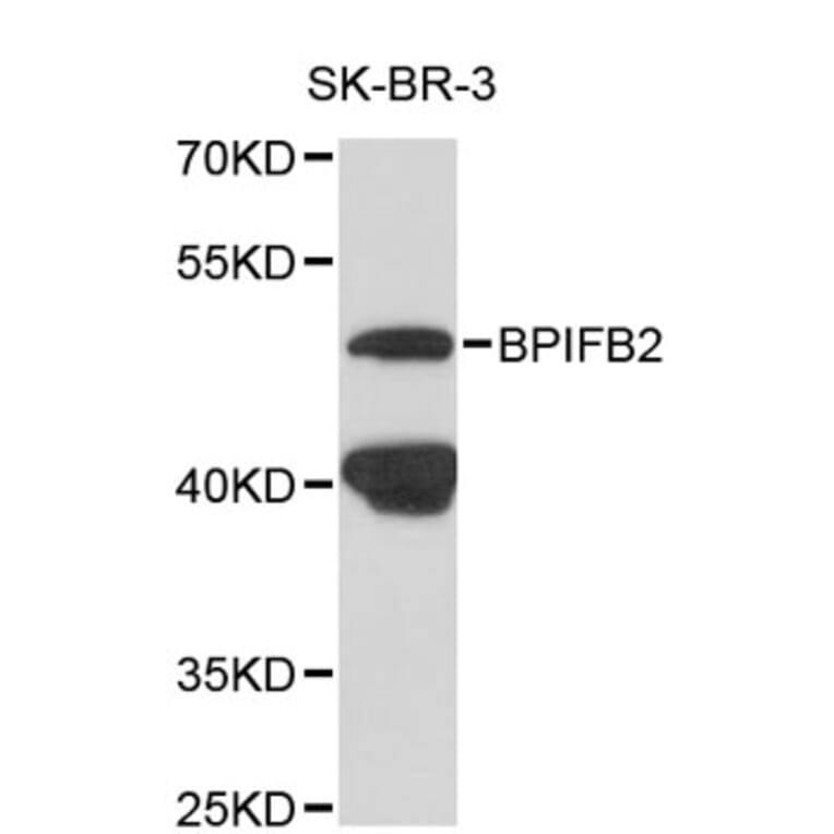 Western Blot - Anti-BPIFB2 Antibody (A8902) - Antibodies.com